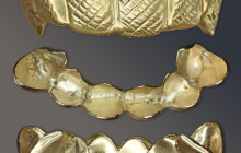 Gold-Grill