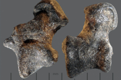 MI-astragalus