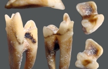 RC2-Bat-tooth